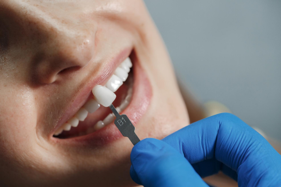 dental implant clinic