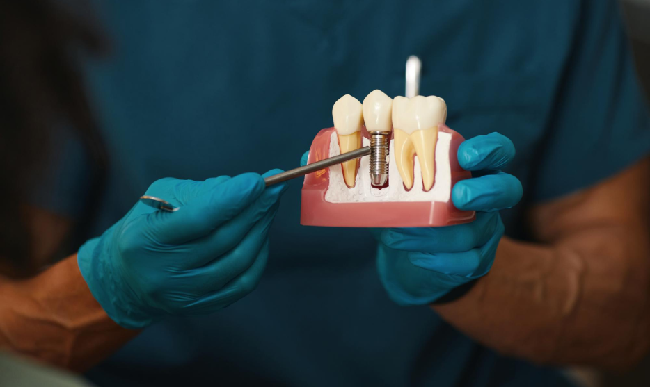 permanent-teeth -replacement