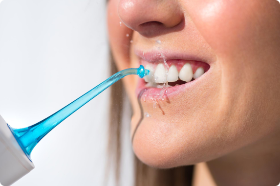 gum-disease-treatment