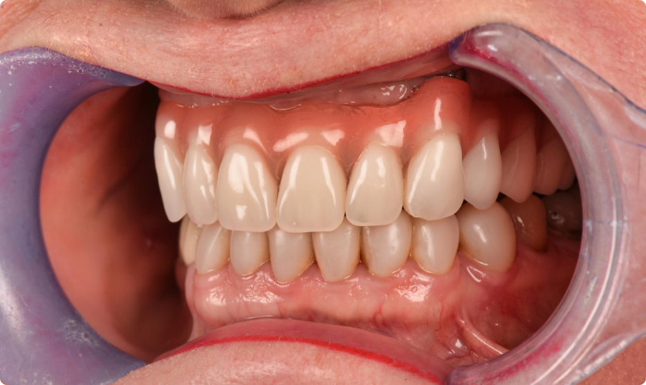 immediate-dental-care